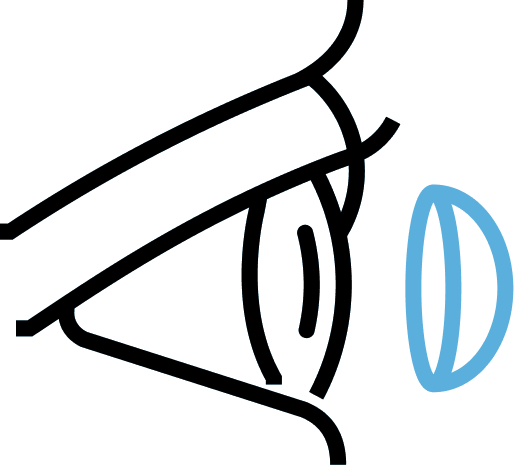 Contact Lens - related Disorders